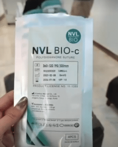 نمونه لیفت نخ کلینیک زیبایی برنا