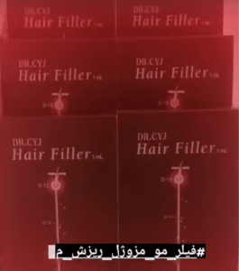 نمونه درمان ریزش م با هیرفیلر دکتر محسن پورآریا