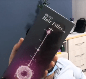 نمونه درمان ریزش م با هیرفیلر دکتر محسن پورآریا