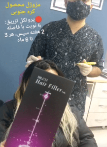 نمونه درمان ریزش م با هیرفیلر دکتر محسن پورآریا
