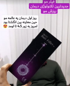 نمونه درمان ریزش م با هیرفیلر دکتر محسن پورآریا