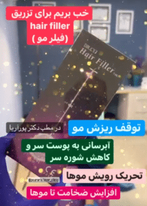 نمونه درمان ریزش م با هیرفیلر دکتر محسن پورآریا