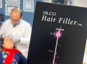 نمونه درمان ریزش م با هیرفیلر دکتر محسن پورآریا