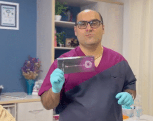 نمونه درمان ریزش م با هیرفیلر دکتر محسن پورآریا