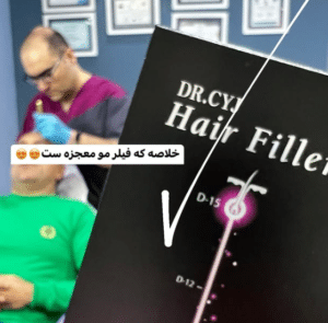 نمونه درمان ریزش م با هیرفیلر دکتر محسن پورآریا