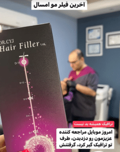 نمونه درمان ریزش م با هیرفیلر دکتر محسن پورآریا