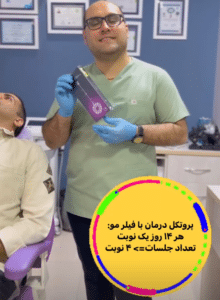 نمونه درمان ریزش م با هیرفیلر دکتر محسن پورآریا