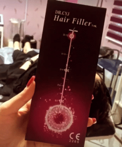 نمونه درمان ریزش مو با هیرفیلر دکتر صادق هاشمی نسب