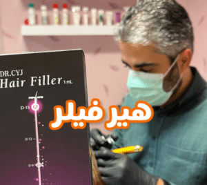 نمونه درمان ریزش مو با هیرفیلر دکتر صادق هاشمی نسب