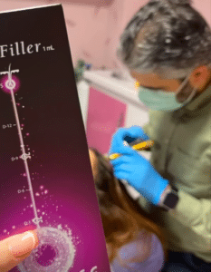 نمونه درمان ریزش مو با هیرفیلر دکتر صادق هاشمی نسب