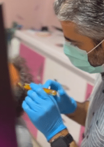 نمونه درمان ریزش مو با هیرفیلر دکتر صادق هاشمی نسب