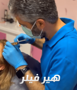 نمونه درمان ریزش مو با هیرفیلر دکتر صادق هاشمی نسب