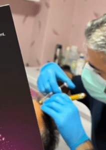 نمونه درمان ریزش مو با هیرفیلر دکتر صادق هاشمی نسب