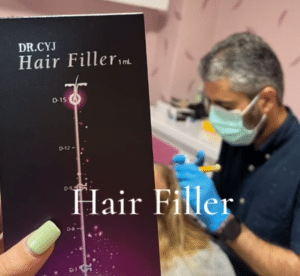 نمونه درمان ریزش مو با هیرفیلر دکتر صادق هاشمی نسب