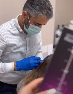 نمونه درمان ریزش مو با هیرفیلر دکتر صادق هاشمی نسب