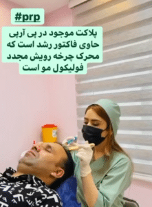 درمان ریزش مو با پی آر پی دکتر گالیا رنجبر