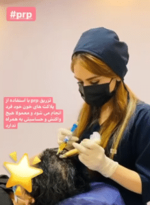 درمان ریزش مو با پی آر پی دکتر گالیا رنجبر