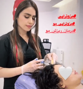 درمان ریزش مو با مزوتراپی دکتر گالیا رنجبر