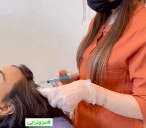 درمان ریزش مو با مزوتراپی دکتر گالیا رنجبر