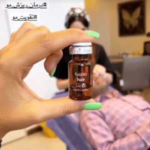 درمان ریزش مو با مزوتراپی دکتر گالیا رنجبر