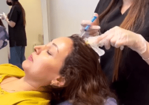 درمان ریزش مو با مزوتراپی دکتر گالیا رنجبر