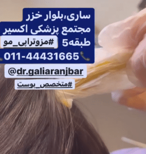 درمان ریزش مو با مزوتراپی دکتر گالیا رنجبر