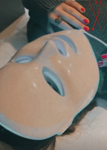 نمونه پاکسازی پوست کلینیک زیبایی کاژه