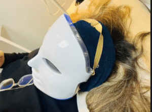 نمونه پاکسازی پوست کلینیک زیبایی کاژه