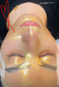 نمونه پاکسازی پوست کلینیک زیبایی کاژه