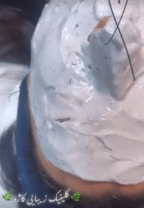 نمونه پاکسازی پوست کلینیک زیبایی کاژه