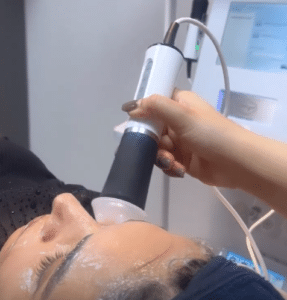 نمونه پاکسازی پوست کلینیک زیبایی کاژه