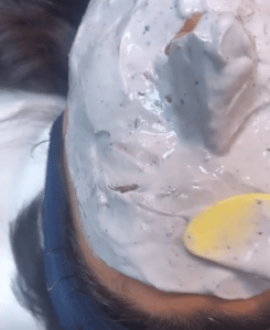 نمونه پاکسازی پوست کلینیک زیبایی کاژه