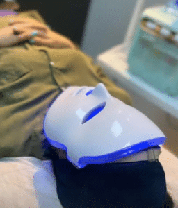 نمونه پاکسازی پوست کلینیک زیبایی کاژه