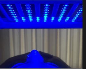 نمونه پاکسازی پوست کلینیک زیبایی کاژه