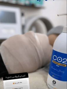 نمونه پاکسازی پوست کلینیک زیبایی کاژه