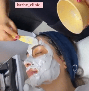 نمونه پاکسازی پوست کلینیک زیبایی کاژه