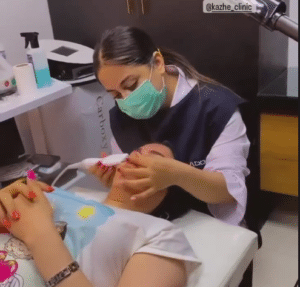 نمونه پاکسازی پوست کلینیک زیبایی کاژه