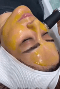 نمونه پاکسازی پوست کلینیک زیبایی کاژه