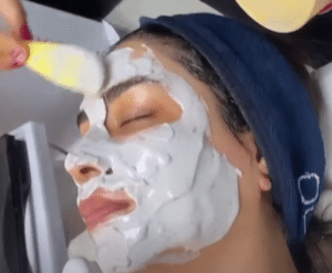 نمونه پاکسازی پوست کلینیک زیبایی کاژه