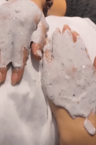 نمونه پاکسازی پوست کلینیک زیبایی کاژه