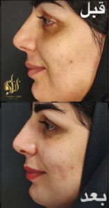 نمونه پاکسازی پوست کلینیک زیبایی برنا