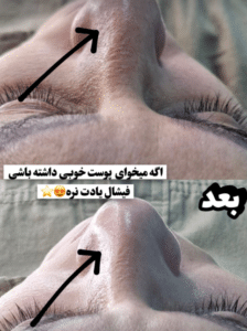 نمونه پاکسازی پوست کلینیک زیبایی برنا