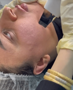 نمونه پاکسازی پوست کلینیک زیبایی برنا