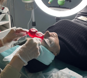 نمونه پاکسازی پوست کلینیک زیبایی برنا