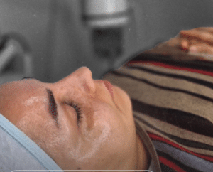 نمونه پاکسازی پوست کلینیک زیبایی برنا