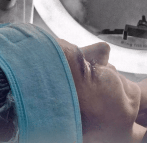 نمونه پاکسازی پوست کلینیک زیبایی برنا