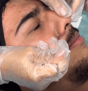 نمونه پاکسازی پوست کلینیک زیبایی برنا