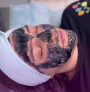 نمونه پاکسازی پوست کلینیک زیبایی برنا