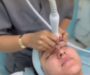 نمونه پاکسازی پوست کلینیک زیبایی برنا