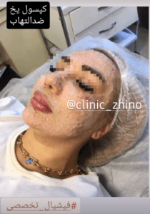 نظر کاربر اینستاگرام (کلینیک زیبایی ژینو)